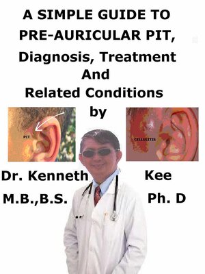 cover image of A Simple Guide to Pre-auricular Pit, Diagnosis, Treatment and Related Conditions